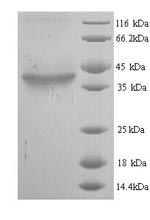 SDS-PAGE
