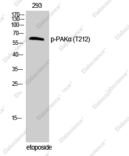 Вестерн-блоттинг, Phospho-PAK1 (Thr212), клетки 293T
