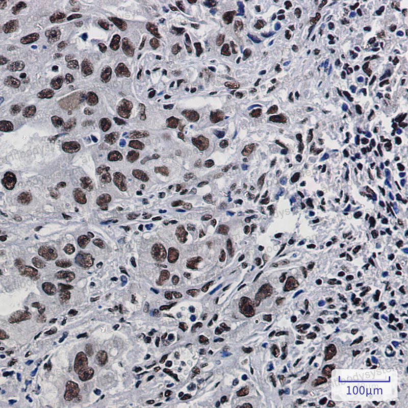 Валидация AntibodySystem RHD26601