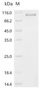 SDS-PAGE