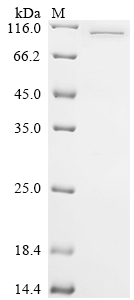 SDS-PAGE