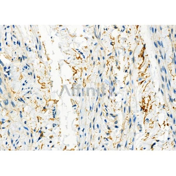 Валидация Affinity DF7444 - 19197