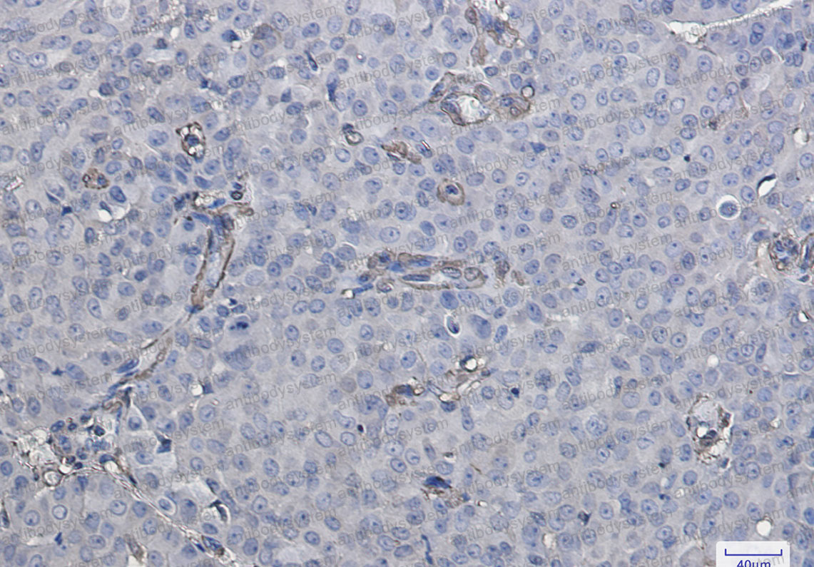 Валидация AntibodySystem RHC40103