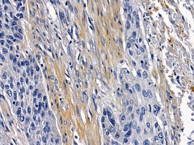 Валидация Affinity DF2381 - 12967