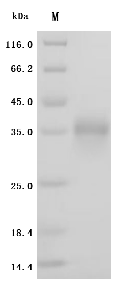 SDS-PAGE