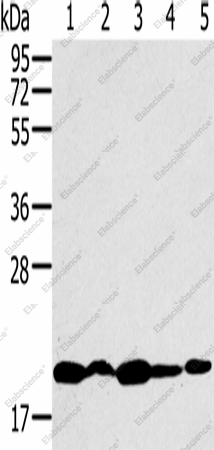 Вестерн-блоттинг, RNF5, клетки K562, 231, Jurkat, HeLa и 293T