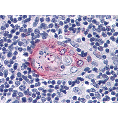 Валидация Affinity BF0664 - 5358