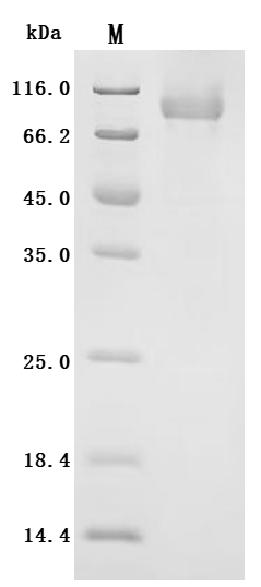 SDS-PAGE