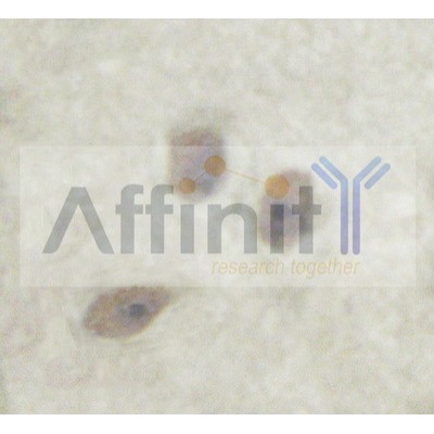 Валидация Affinity AF6205 - 3441