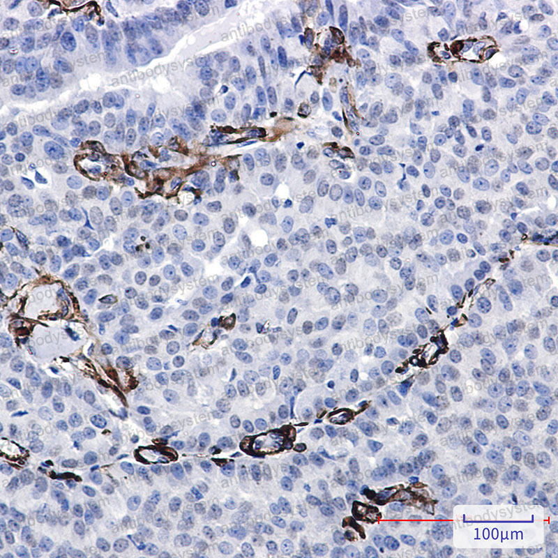 Валидация AntibodySystem RHG05601