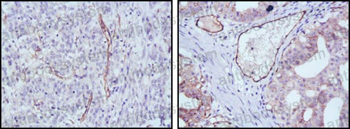 Валидация AntibodySystem RHD84202