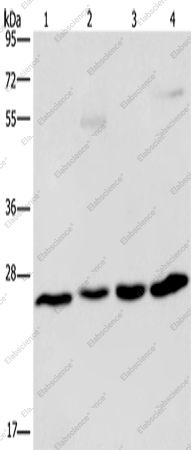 Вестерн-блоттинг, ETHE1, клетки A549, ткань гепатоцеллюлярной карциномы человека, ткань печени мыши, клетки HT-29