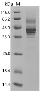 SDS-PAGE
