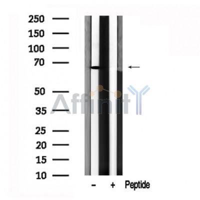 Валидация Affinity AF7615 - 4285