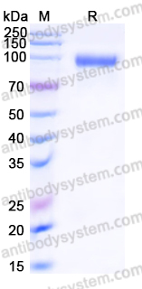 EMJ41801, SDS-PAGE