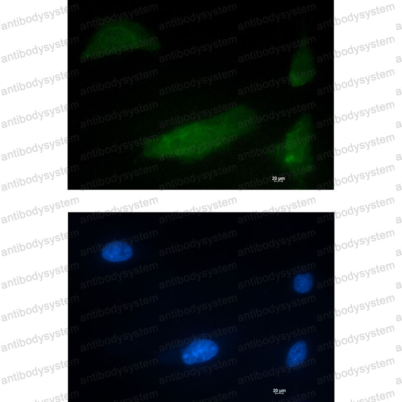 Валидация IF - AntibodySystem RHN29801