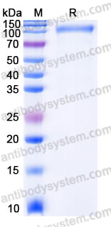 EHJ45502, SDS-PAGE