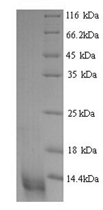 SDS-PAGE