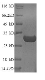 SDS-PAGE