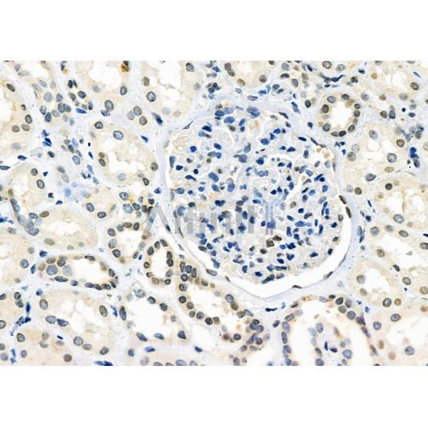 Валидация Affinity AF9108 - 4881