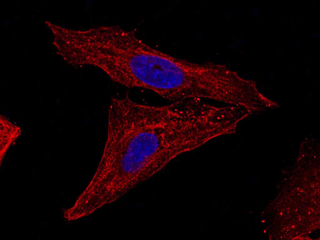 Валидация Elabscience AN005320L