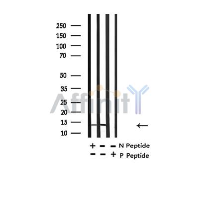 Валидация Affinity AF4361 - 2198