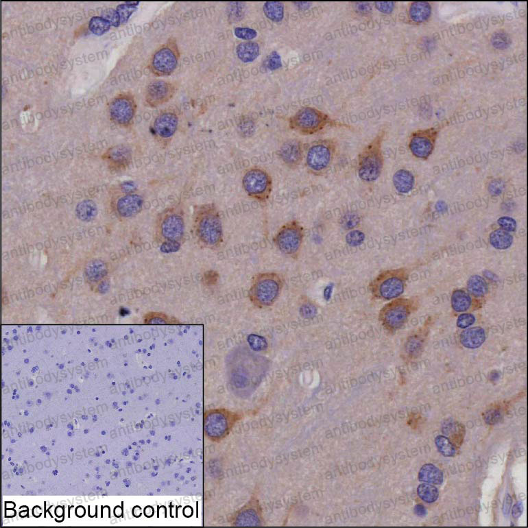 Валидация AntibodySystem RHD94701