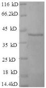 SDS-PAGE
