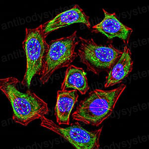 Валидация IF - AntibodySystem RHN97202