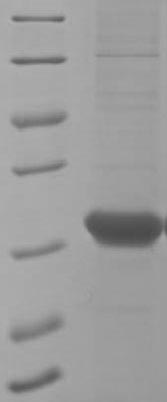SDS-PAGE