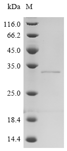 SDS-PAGE