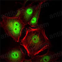 Валидация IF - AntibodySystem RHC20205