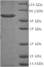 SDS-PAGE