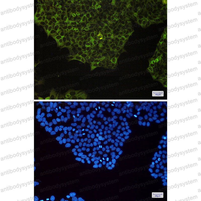Валидация IF - AntibodySystem RHF83101