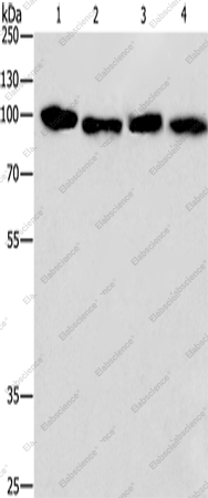 Вестерн-блоттинг, CANX, клетки HeLa и 231, ткань плаценты человека и карцинома сигмовидной кишки