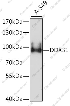 Вестерн-блоттинг, DDX31, клетки A-549