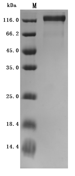 SDS-PAGE