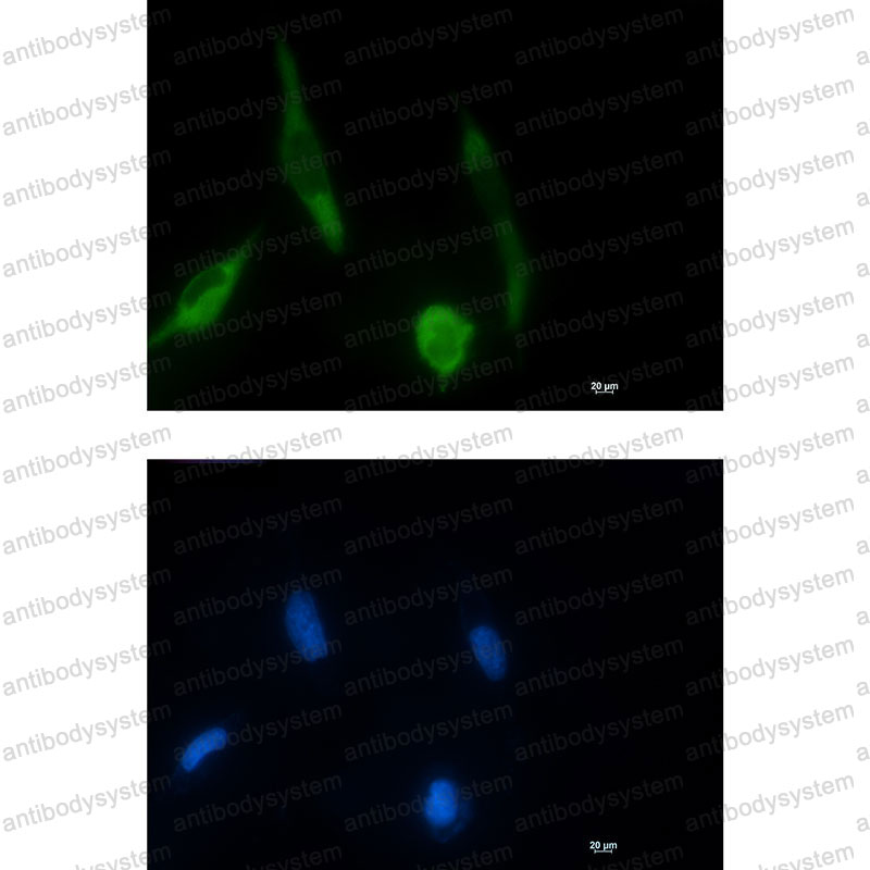 Валидация IF - AntibodySystem RHF95506