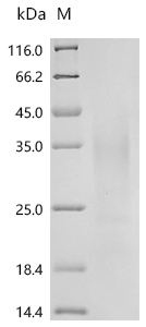 SDS-PAGE