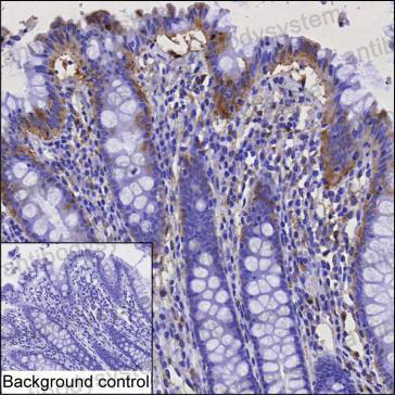 Валидация AntibodySystem RHG01401