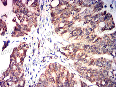 Валидация AntibodySystem RHD01401