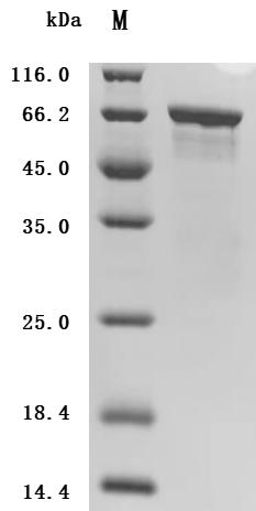 SDS-PAGE
