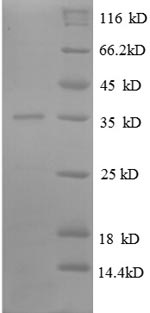 SDS-PAGE