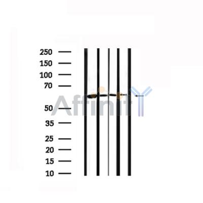 Валидация Affinity DF6211 - 17480