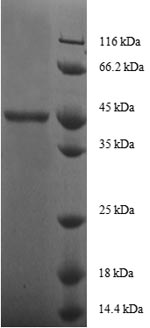 SDS-PAGE