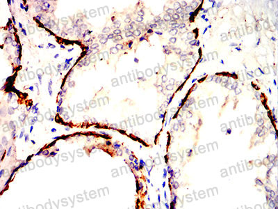 Валидация AntibodySystem RHB98004 (514)