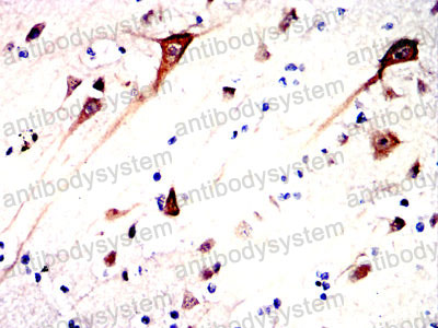 Валидация AntibodySystem RHG08906