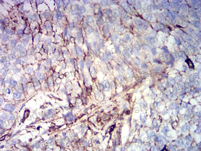 Валидация AntibodySystem RHD14803 (1357)