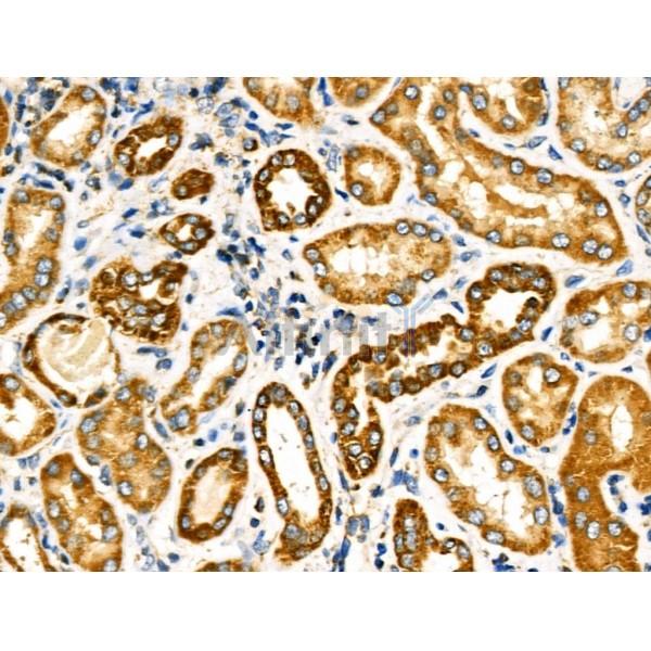 Валидация Affinity AF5277 - 2804