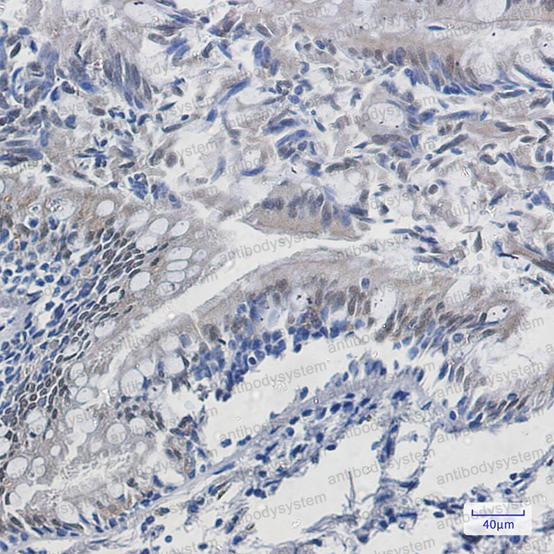 Валидация AntibodySystem RHB44301